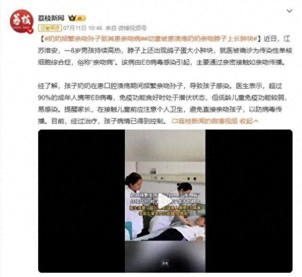 胜宇配资 别再亲孩子脸颊​了！小心这种病！